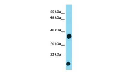 Western Blot: DCUN1D2 Antibody [NBP2-84763] - Host: Rabbit. Target Name: Dcun1d2. Sample Type: Mouse Heart lysates. Antibody Dilution: 1.0ug/ml