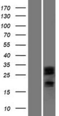 Western Blot DCUN1D2 Overexpression Lysate