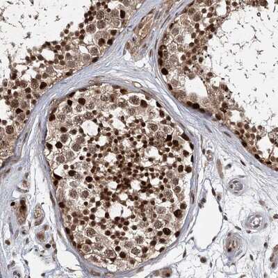 Immunohistochemistry-Paraffin DCUN1D4 Antibody - BSA Free