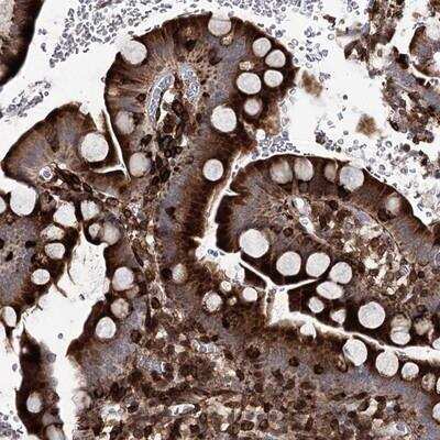 Immunohistochemistry-Paraffin DCUN1D4 Antibody - BSA Free