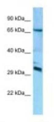 Western Blot: DCUN1D4 Antibody [NBP1-98384] - Mouse Brain Lysate 1.0ug/ml, Gel Concentration: 12%