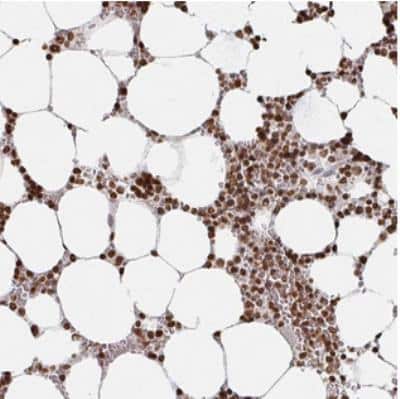 Immunohistochemistry: DCUN1D5 Antibody [NBP2-30432] - Staining of human bone marrow shows strong nuclear positivity in hematopoietic cells.