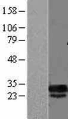 Western Blot: DCUN1D5 Overexpression Lysate (Adult Normal) [NBL1-09759] Left-Empty vector transfected control cell lysate (HEK293 cell lysate); Right -Over-expression Lysate for DCUN1D5.