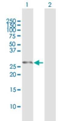 Western Blot: DCXR Antibody [H00051181-B01P] - Analysis of DCXR expression in transfected 293T cell line by DCXR polyclonal antibody.  Lane 1: DCXR transfected lysate(26.84 KDa). Lane 2: Non-transfected lysate.