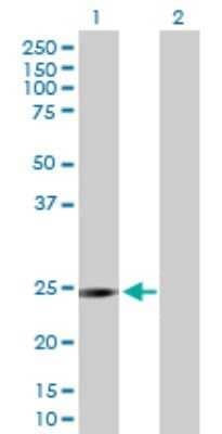 Western Blot: DCXR Antibody [H00051181-D01P] - Analysis of DCXR expression in transfected 293T cell line by DCXR polyclonal antibody.Lane 1: DCXR transfected lysate(25.90 KDa).Lane 2: Non-transfected lysate.