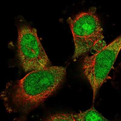 Immunocytochemistry/ Immunofluorescence DDA1 Antibody - BSA Free