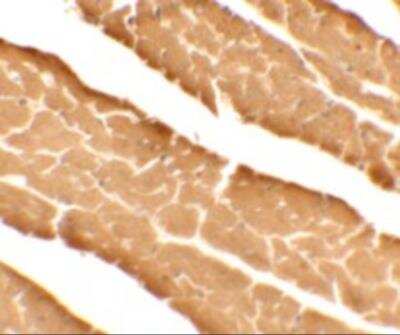 Immunohistochemistry: DDA1 Antibody [NBP2-81982] - Analysis of DDA1 in mouse heart tissue with DDA1 antibody at 5 ug/ml.