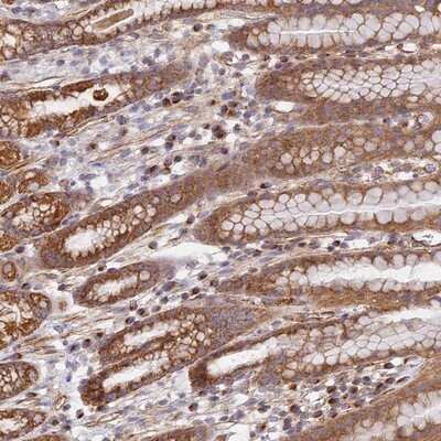 Immunohistochemistry-Paraffin: DDA1 Antibody [NBP1-89891] - Staining of human stomach, lower shows moderate cytoplasmic positivity in glandular cells.