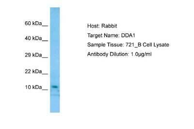 Western Blot: DDA1 Antibody [NBP1-98537] - Antibody Dilution: 1.0ug/ml Sample Tissue: 721_B cell lysate.