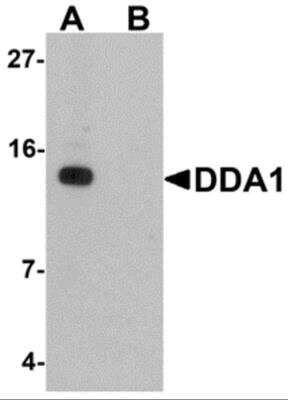 Western Blot DDA1 Antibody - BSA Free