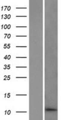 Western Blot: DDA1 Overexpression Lysate (Adult Normal) [NBP2-06359] Left-Empty vector transfected control cell lysate (HEK293 cell lysate); Right -Over-expression Lysate for DDA1.
