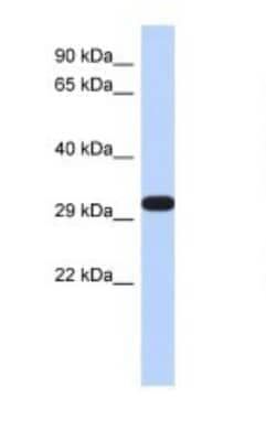 Western Blot DDAH2 Antibody