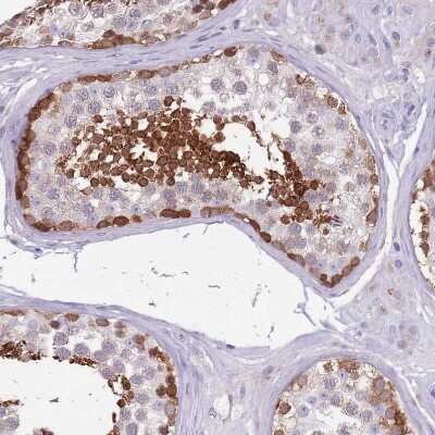 Immunohistochemistry-Paraffin DDHD1 Antibody - BSA Free