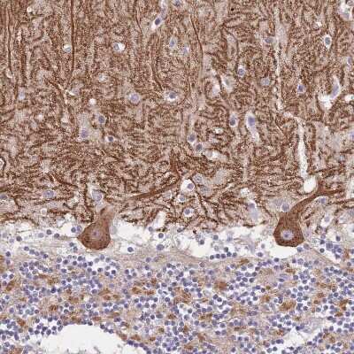 Immunohistochemistry-Paraffin DDHD1 Antibody - BSA Free