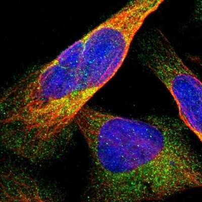 Immunocytochemistry/Immunofluorescence: DDHD2 Antibody [NBP1-82965] - Immunofluorescent staining of human cell line U-2 OS shows localization to cytosol.