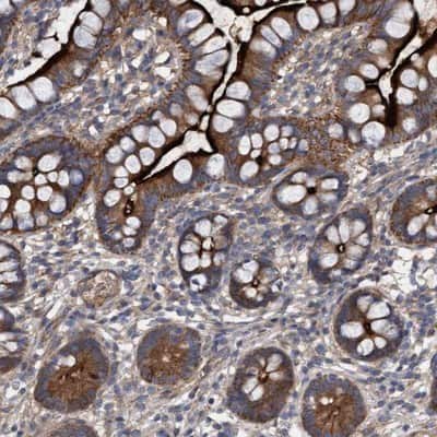 Immunohistochemistry-Paraffin: DDHD2 Antibody [NBP1-82965] - Staining of human small intestine shows strong positivity in glandular cells.