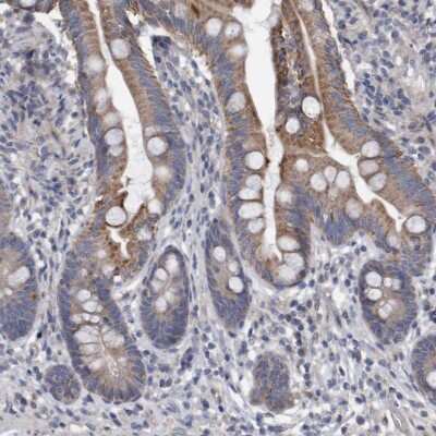 Immunohistochemistry-Paraffin DDHD2 Antibody - BSA Free