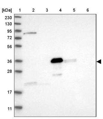 Western Blot DDHD2 Antibody - BSA Free