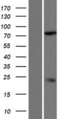 Western Blot DDHD2 Overexpression Lysate