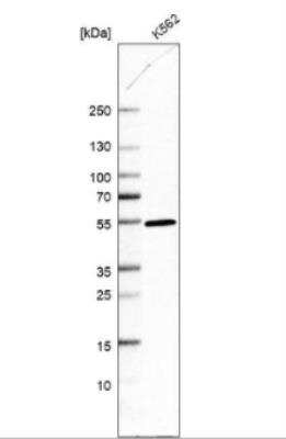 Western Blot DDI2 Antibody