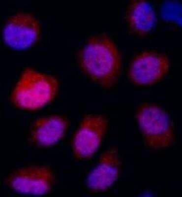 Immunocytochemistry/Immunofluorescence: DDIT4 Antibody [NBP1-22966] - NBF-fixed asynchronous, cobalt-treated HeLa cells. Antibody: Affinity purified rabbit anti-REDD1 used at a dilution of 1:500 (2 ug/ml). Detection: Red-fluorescent goat anti-rabbit IgG H&L crossadsorbed Antibody DyLight®594 used at 1:100.