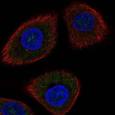 Immunocytochemistry/Immunofluorescence: DDIT4 Antibody [NBP1-85211] - Staining of human cell line hTCEpi shows localization to cytosol.