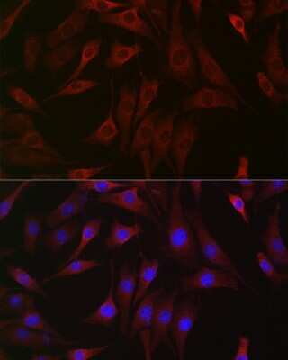 Immunocytochemistry/Immunofluorescence: DDIT4 Antibody [NBP2-92942] - Immunofluorescence analysis of NIH/3T3 cells using [KO Validated] DDIT4 Rabbit pAb (NBP2-92942) at dilution of 1:50 (40x lens). Blue: DAPI for nuclear staining.