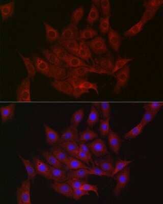 Immunocytochemistry/Immunofluorescence: DDIT4 Antibody [NBP2-92942] - Immunofluorescence analysis of PC-12 cells using [KO Validated] DDIT4 Rabbit pAb (NBP2-92942) at dilution of 1:50 (40x lens). Blue: DAPI for nuclear staining.