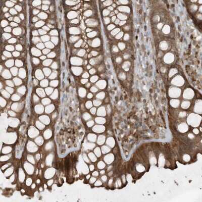 Immunohistochemistry-Paraffin: DDIT4 Antibody [NBP2-38208] - Staining of human rectum shows strong cytoplasmic positivity in glandular cells.