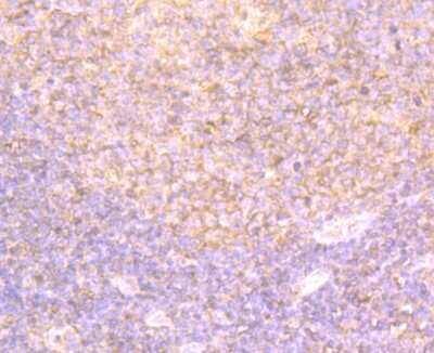 Immunohistochemistry-Paraffin: DDIT4 Antibody [NBP2-80416] - Analysis in human tonsil tissue using DDIT4 antibody. Counter stained with hematoxylin.