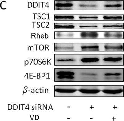 Knockdown Validated: DDIT4 Antibody [NBP1-77321] - siRNA knockdown of the DDIT4 antiproliferative responses to 1,25(OH)2 D3RMCs were transfected with negative control siRNA orDDIT4-specific siRNA in the presence or absence of 1,25(OH) 2 D3 . (C) DDIT4 protein expression levels were detected by Western blot. Image collected and cropped by CiteAb from the following publication (//www.oncotarget.com/lookup/doi/10.18632/oncotarget.23063) licensed under a CC-BY license.