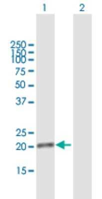 Western Blot: DDIT4L Antibody [H00115265-B01P] - Analysis of DDIT4L expression in transfected 293T cell line by DDIT4L polyclonal antibody.  Lane 1: DDIT4L transfected lysate(21.23 KDa). Lane 2: Non-transfected lysate.