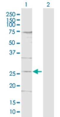 Western Blot: DDIT4L Antibody [H00115265-D01P] - Analysis of DDIT4L expression in transfected 293T cell line by DDIT4L polyclonal antibody.Lane 1: DDIT4L transfected lysate(21.70 KDa).Lane 2: Non-transfected lysate.