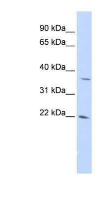 Western Blot DDIT4L Antibody