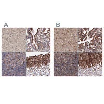 <b>Independent Antibodies Validation. </b>Immunohistochemistry-Paraffin: DDO Antibody [NBP2-32684] - Staining of human cerebral cortex, colon, lymph node and urinary bladder using Anti-DDO antibody NBP2-32684 (A) shows similar protein distribution across tissues to independent antibody NBP1-85884 (B).