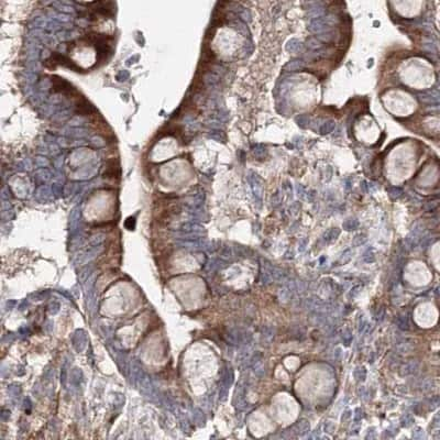 Immunohistochemistry-Paraffin: DDO Antibody [NBP2-32684] - Staining of human colon.