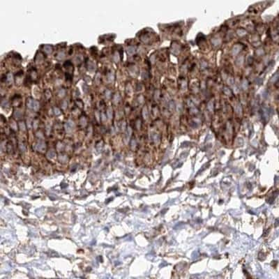 Immunohistochemistry-Paraffin: DDO Antibody [NBP2-32684] - Staining of human urinary bladder.