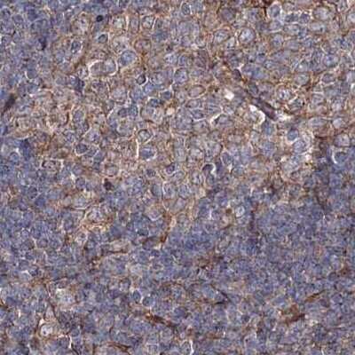 Immunohistochemistry-Paraffin: DDO Antibody [NBP2-32684] - Staining of human lymph node.