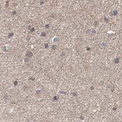 Immunohistochemistry-Paraffin: DDO Antibody [NBP2-32684] - Staining of human cerebral cortex.