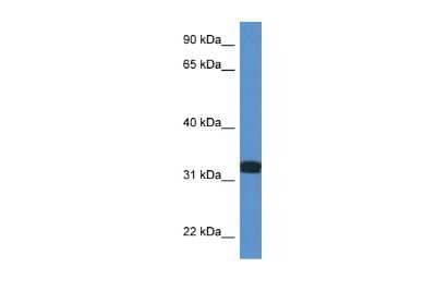 Western Blot: DDO Antibody [NBP3-10666] - Western blot analysis of DDO in Fetal Lung as a positive control. Antibody dilution at 1.0 ug/ml