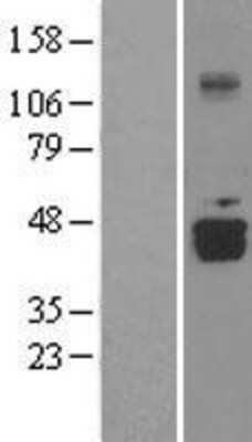 Western Blot DDO Overexpression Lysate