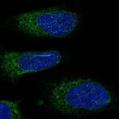 Immunocytochemistry/Immunofluorescence: DDOST Antibody [NBP2-38560] - Immunofluorescent staining of human cell line U-2 OS shows localization to endoplasmic reticulum.