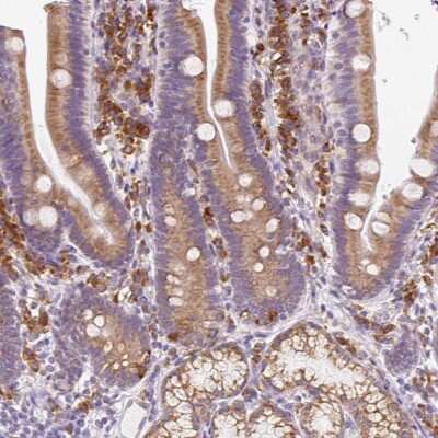 Immunohistochemistry-Paraffin: DDOST Antibody [NBP2-38560] - Staining of human duodenum shows cytoplasmic positivity in leukocytes and glandular cells.