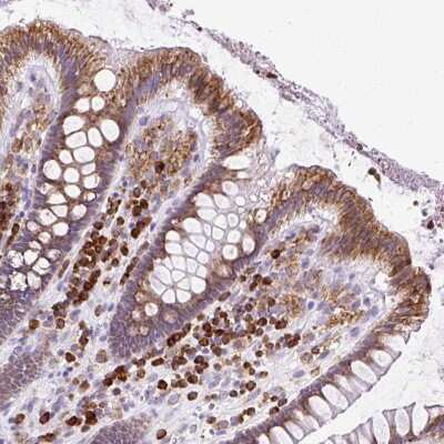 Immunohistochemistry: DDOST Antibody [NBP2-38681] - Staining of human colon shows strong cytoplasmic positivity in glandular cells.