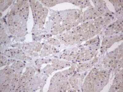 Immunohistochemistry: DDOST Antibody (OTI2B4) - Azide and BSA Free [NBP2-70561] - Analysis of Human bladder tissue. (Heat-induced epitope retrieval by 1 mM EDTA in 10mM Tris, pH8.5, 120C for 3min)