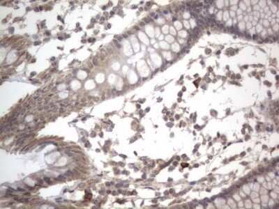 Immunohistochemistry: DDOST Antibody (OTI2B4) - Azide and BSA Free [NBP2-70561] - Analysis of Human colon tissue. (Heat-induced epitope retrieval by 1 mM EDTA in 10mM Tris, pH8.5, 120C for 3min)