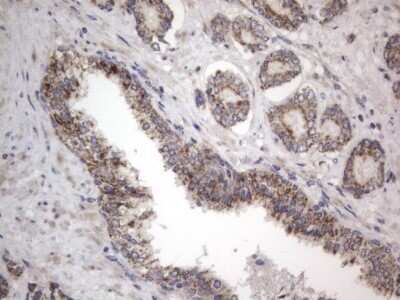 Immunohistochemistry: DDOST Antibody (OTI2B4) - Azide and BSA Free [NBP2-70561] - Analysis of Human prostate tissue. (Heat-induced epitope retrieval by 1 mM EDTA in 10mM Tris, pH8.5, 120C for 3min)