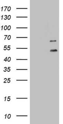 Western Blot: DDOST Antibody (OTI2B4) - Azide and BSA Free [NBP2-70561] - Analysis of HEK293T cells were transfected with the pCMV6-ENTRY control (Left lane) or pCMV6-ENTRY DDOST.