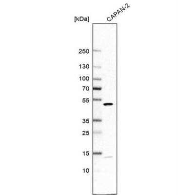 Western Blot DDOST Antibody