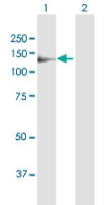 Western Blot: DDR1 Antibody [H00000780-B01P] - Analysis of DDR1 expression in transfected 293T cell line by DDR1 polyclonal antibody.  Lane 1: DDR1 transfected lysate(96.36 KDa). Lane 2: Non-transfected lysate.
